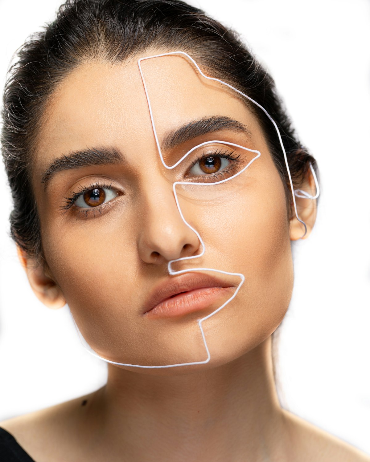Cheek Fillers at Enfield Royal Clinic Khalifa City
