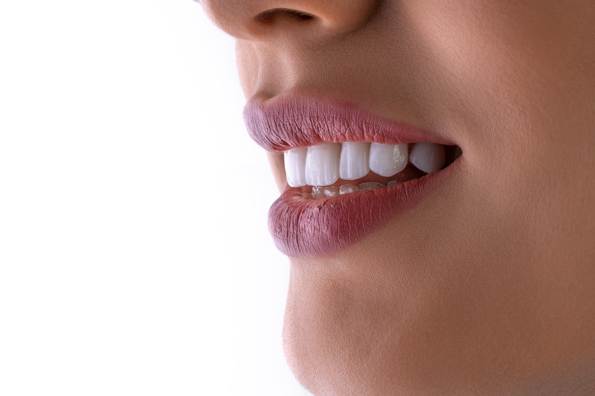 Hollywood Smile & Veneers at Enfield Royal Clinic Khalifa City