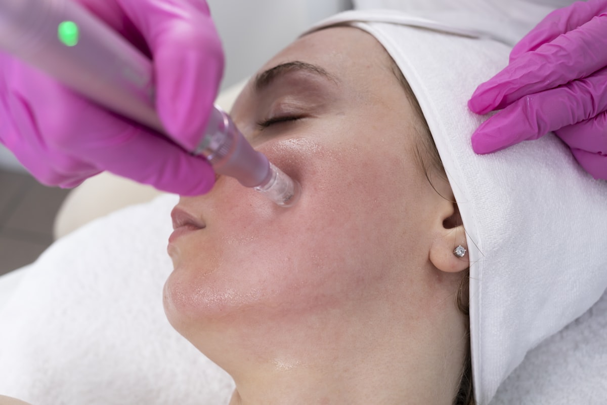 Microneedling — Enfield Royal Clinic Khalifa City