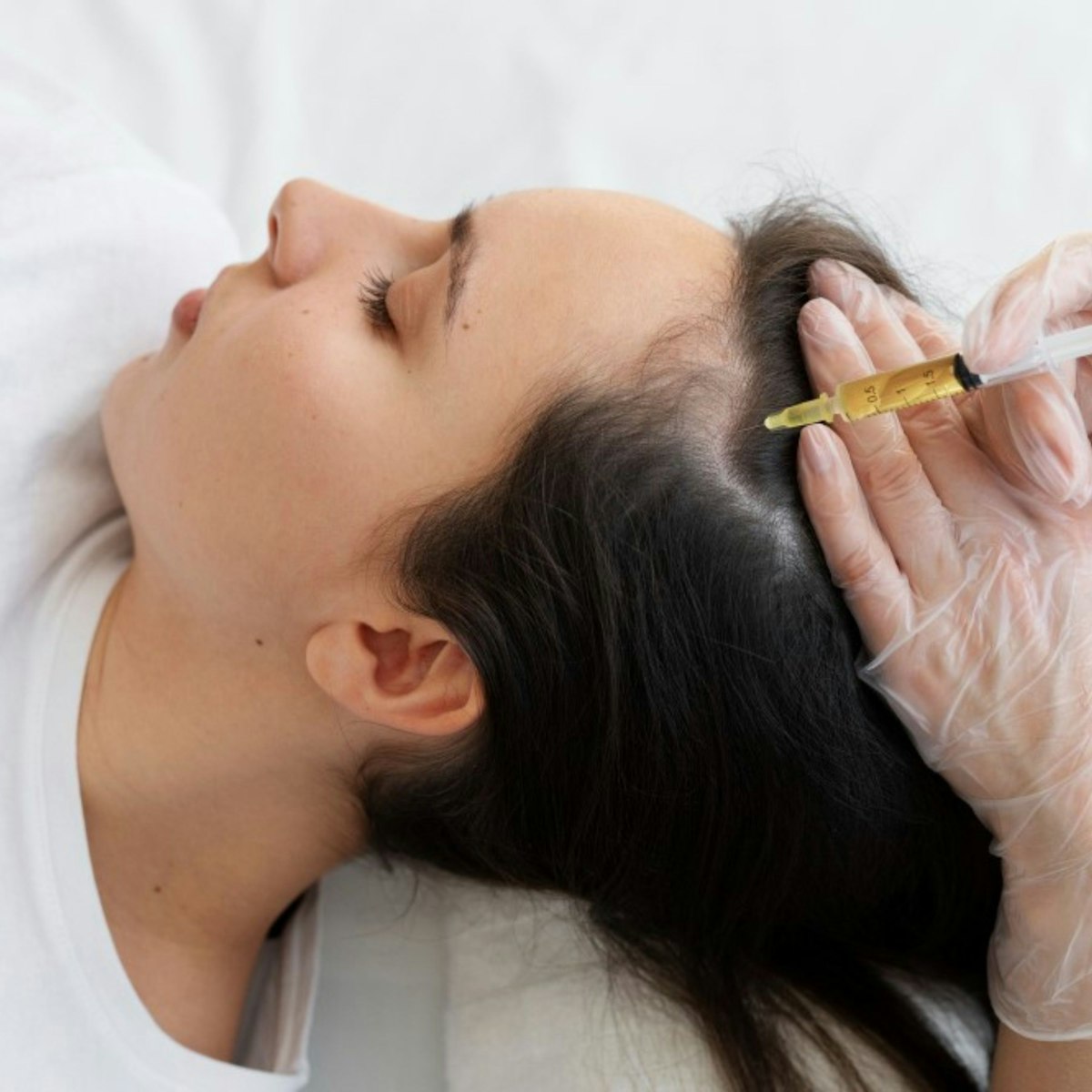 PRP for Hair Loss — Enfield Royal Clinic Khalifa City
